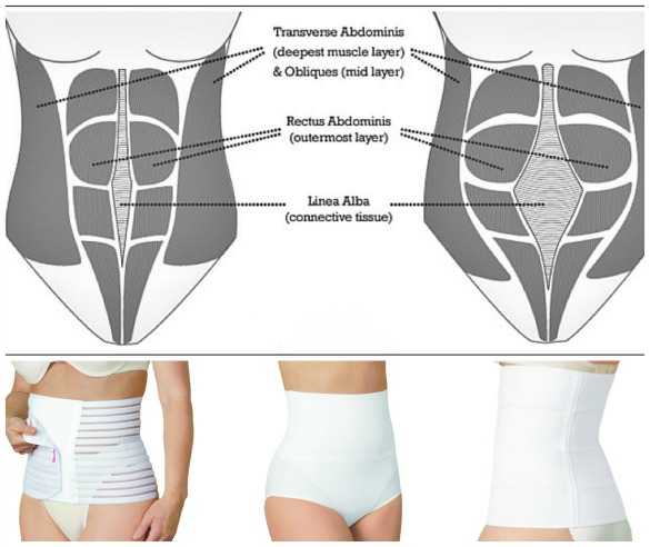 Do Postpartum Belly Bands And Girdles Really Work