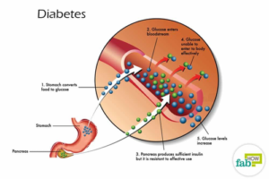 Gestational Diabetes | Lucie's List