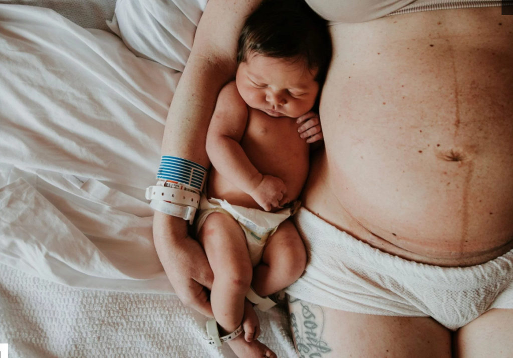Moms And Their Post-Pregnancy Bodies Are Strong And Amazing, And